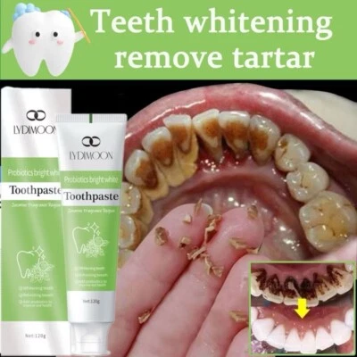 5x Teeth whitening toothpaste 120g tartar remover fresh - Image 1 of 4