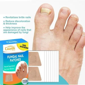 Waterproof Nail Repair Patches Nail Repair Stickers Foot NEW- Tools Sticky I2W8 - Picture 1 of 13