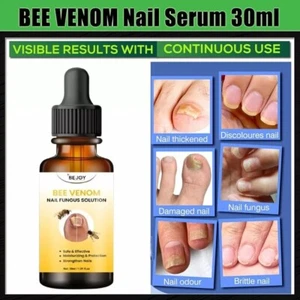7-Day BEE VENOM Toenail Fungus Treatment – Extra Strength Repair for Nails 30ML - Picture 1 of 6