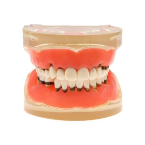 Modelo Dental Enfermedad Periodontal Patológica Adultos para Estudio Enseñar Dientes M4017 - Imagen 1 de 15