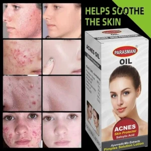 Ayurvedic Face Oil For Acne ,Anti-Ageing & Skin Soothing with Salicylic Acid 3ml - Picture 1 of 5