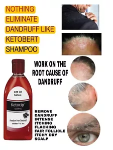 Anti dandruff natural shampoo for extreme dandruff fungus - Picture 1 of 1