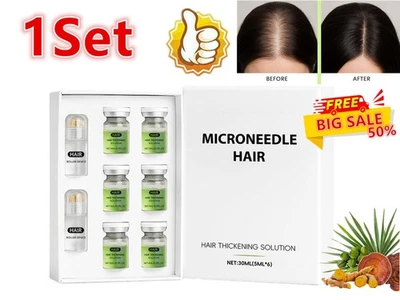 1SET Haarwuchssystem, Erweiterte Haarwuchsbehandlung Ginseng g - Bild 1 von 4