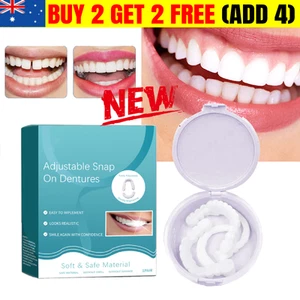 Veenora Clip-On Veneers, Lonryd Smileflex, Adjustable Snap-On Teeth - Picture 1 of 10