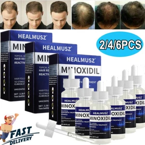 2-6X Extra Stärke Minoxidil 5% Serum Haarwuchslösung für Männer 2-6 Monatsvorrat - Bild 1 von 21