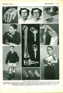 Cabinet de curiosité anatomie humaine prothèse externe issue livre 1952