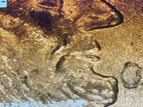 2000P  Lincoln Memorial Penny Error - 🔥Duck Lip Lincoln🔥 Awesome Error Coin! Cover