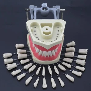 Dental Typodont Columbia 860 Teeth Model Removeable Screw UR UL LL LR 1 3 4 6 - Picture 1 of 115