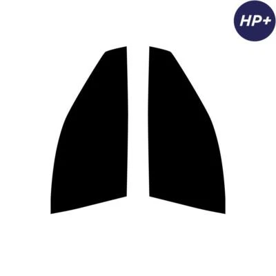 For Lexus IS 4-door Berlina 2014+ Carbon Pre Cut Window Tint Front Premium HP+ - Image 1 of 4