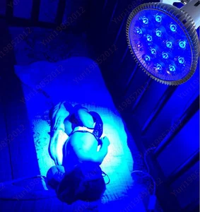 485nM 15 Watts Baby Care Neonatal Jaundice Phototherapy LED Blue Ray Light Lamp - Picture 1 of 12