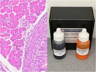 Kit de manchas de hematoxilina y eosina VitroView™ (30 ml/botella) (CAT# VB-3000S) Foto 1 de 3