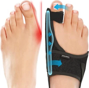 Treatmedy Bunion Fix Toe Valgus Corrector Adjustable Orthosis Splints (1 PAIR) - Picture 1 of 7
