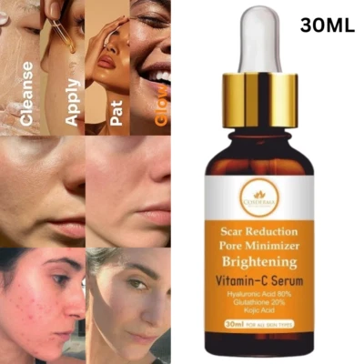 Vitamin C Serum for Face with Kojic Acid For Best Skin Acne, Blemishes 30ML - Image 1 of 4
