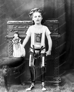 Girl Artificial Legs With Doll 1890 Vintage 8x10 Reprint Of Old Photo - Picture 1 of 1