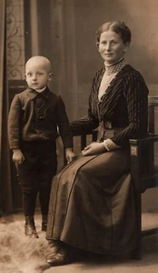 LOVELY MOTHER AND HER SICK BALD CHILD : RPPC - Picture 1 of 3