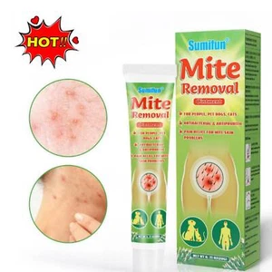 Mite Removal Oint ments Anti Itching Scabies Kill Head Li ce Treatment Cream UK - Picture 1 of 11