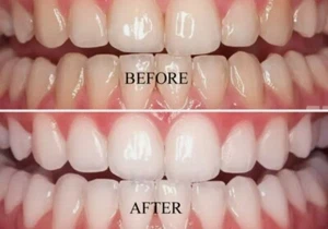 2x100% Genuine! 2xNu Skin AP-24 Whitening Fluoride Toothpaste (No peroxide) UK - Picture 1 of 2