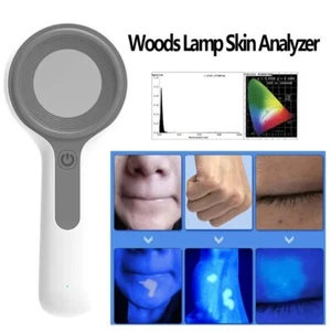 Lámpara de madera UV examen dermatología analizador de piel para vitiligo CE FDA - Imagen 1 de 13