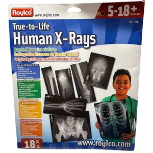 Roylco Kit Educativo Rayos X Humanos Real a la Vida 18 Piezas Edades 5+ Ciencia Anato - Imagen 1 de 3