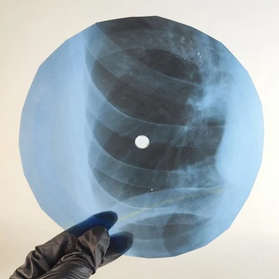 BO DIDDLEY WHO DO YOU LOVE X-Ray USSR Record Roentgen Bone Ribs Music Vinyl - Image 1 of 2