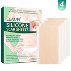 Silicone Gel Strips Patch Scar Away Treatment Sheet W8J8 Tape W4F8 S8R9