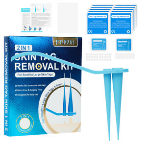 Skin Tag Remover Face Mole Wart Micro Band Rubber Rings Tag Remover Tool Kit