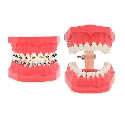Dental Typodont Orthodontic Teeth Model with Metal Braces for Brushing Practice - Image 1 of 4