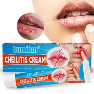 Cheilitis Cream Inflammation Labial Herpes Antibacterials Ointment Chapped G1W9 - Picture 1 of 13