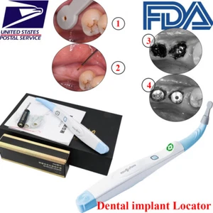Dental Implant Surgical Implant Locator Detector Abutment Finder Rotation Sensor - Picture 1 of 8