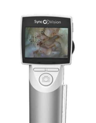 Vividia VO-101 Portable Handhled HD Veterinary Otoscope with 1.5" LCD & WiFi - Image 1 of 4