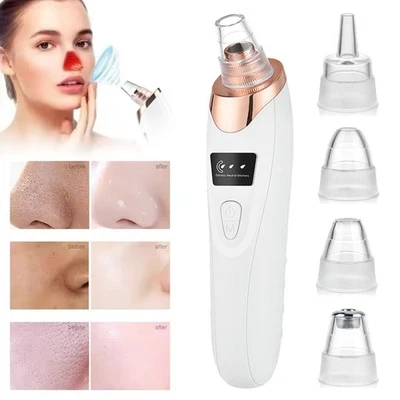 Electric Blackhead Remover Vacuum Pore Cleaner Acne Comedone Extractor Face Pore - Image 1 of 4