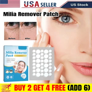 Milia Remover Patches for Milia Spot Treatment Soften Eye Skin Care 144PCS - Picture 1 of 11