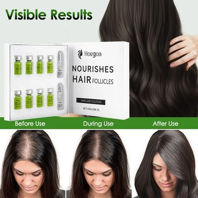 8Pcs/Set Hair Regrowth System Advanced Hair Growth Treatment with Ginseng Serum - Image 1 of 4