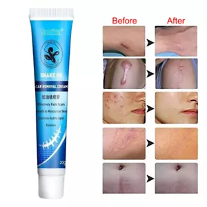 Powerful Skin Repair Healing Scar Cream Remove Burns Cuts Ointment Stretch Marks - Picture 1 of 9