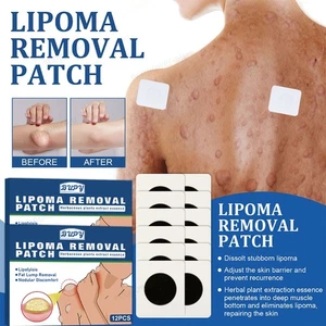 Anti-Schwellungs-Pflaster zur Entfernung von Lipomen Lipolysis Fat Lump Relief - Picture 1 of 14