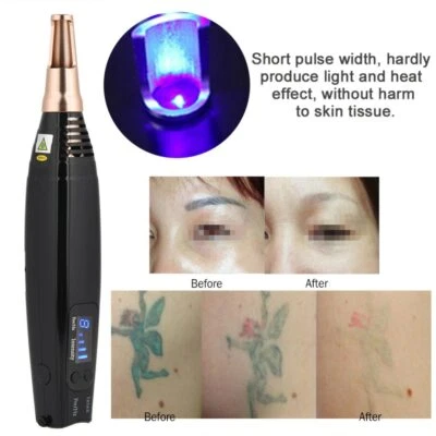 Laser Pen Tattoo Dark Spot Acne Freckle Removal Machine Eyebrow Pigment Makeup - Image 1 of 4