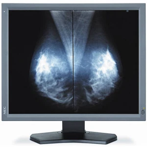 NEC Einzelmonitor MD211G5 Lösung Nicht ein Paar, sondern nur ein Monitor 4000074 - Bild 1 von 1