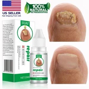 Extra Strength Toenail Fingernail Fungus Treatment Nail Repair Renewal Solution - Picture 1 of 9