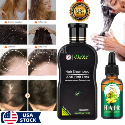 Dexe Fast Hair Growth Shampoo Natural Herbal Anti Hair Loss Treatment Serum Oil - Image 1 of 4