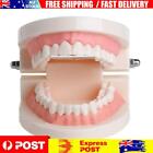 Pvc Dental Mold Giant Standard Tooth Implant Model Useful Medical Teaching Aids