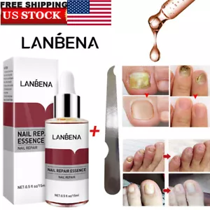 Nail Anti Fungus Treatment For Toe Fingers Maximum Strength Nail Fungus Remover - Picture 1 of 13