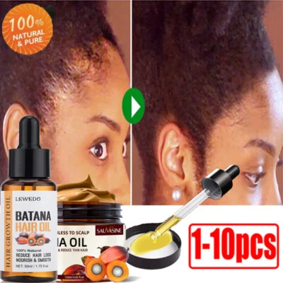 Batana Oil Conditioner for Hair Growth, Anti Hair Loss, Healthier Thicker Fuller - Image 1 of 4