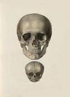 Antique Medical Adult & Infant Skull A3 Poster Re Print