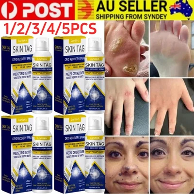 Timilk Chill Erase Bump Renewal Spray Soothing And Cooling Formula Absorbs Quick - image 1 of 4