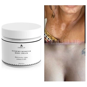 Sunburn Remover Body Cream, Dark Mark Fade Cream - Picture 1 of 6