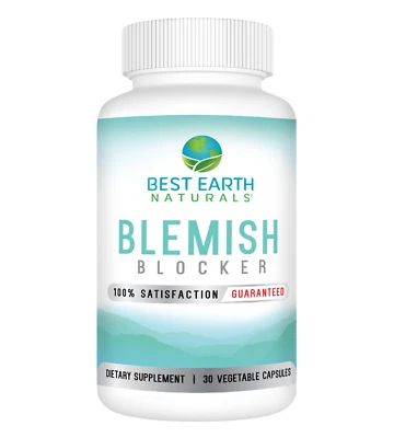 Bloqueador de manchas | Suplemento avanzado de apoyo para la piel | Best Earth Naturals Foto 1 de 4