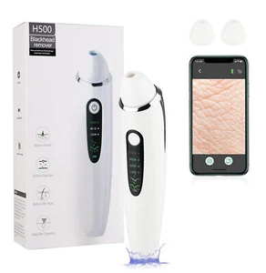 Electric Facial Skin Care Pore Blackhead Cleaner Remover Vacuum Acne Cleanser US - Picture 1 of 10
