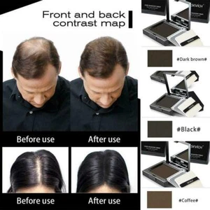 12g Hair Line Powder Shadow Control Hair Concealer Root Cover F6Y4 - Picture 1 of 10