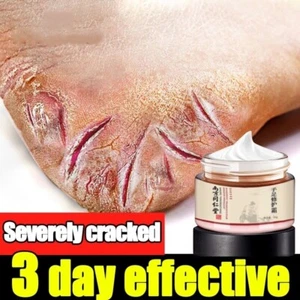 Horse Oils Foot Care Cream 50g Crack Heal Cream Foot Mask Remove Dead Skin - Picture 1 of 8