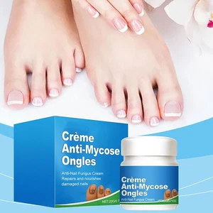 Crema Cura Unghie 20g - Anti-Motore, Rinforzo e Ripristino Unghie - Foto 1 di 12